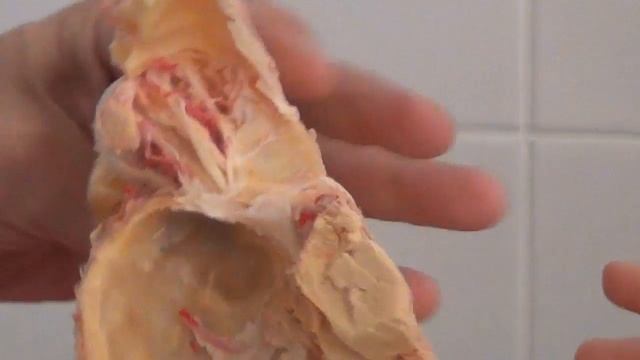 Тройничный нерв препарат смотреть онлайн