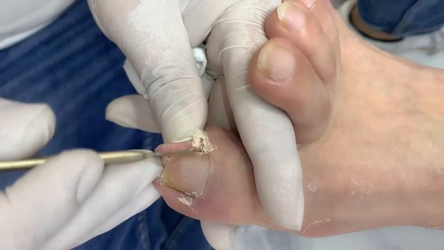 Professional nail cuticle cleaning смотреть онлайн