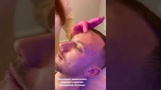 БОТУЛИНОТЕРАПИЯ ДЛЯ МУЖЧИН??♂️ смотреть онлайн
