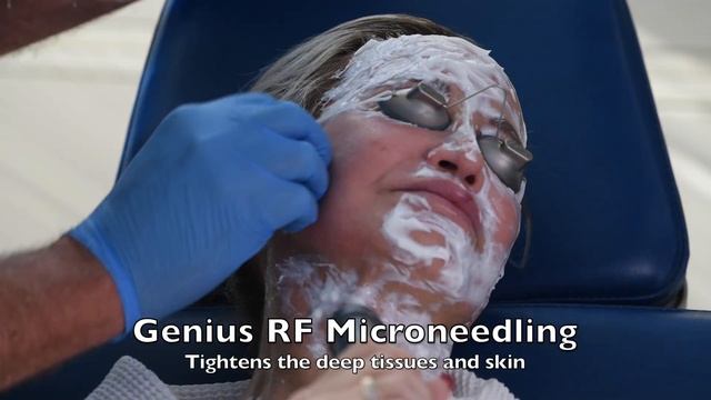Lutronic Genius plus Evo fractional CO2 face neck VC R + C смотреть онлайн