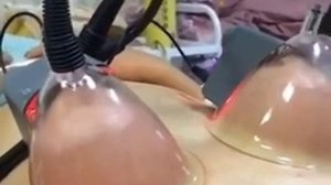 Вакуумный Массажёр для увеличения Груди, Попы, а также массаж всего тела и лица+RF!