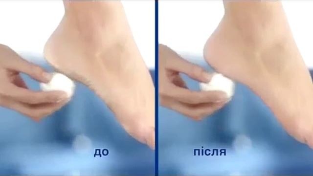 Електрична пилка Scholl — для ідеально гладеньких стоп смотреть онлайн