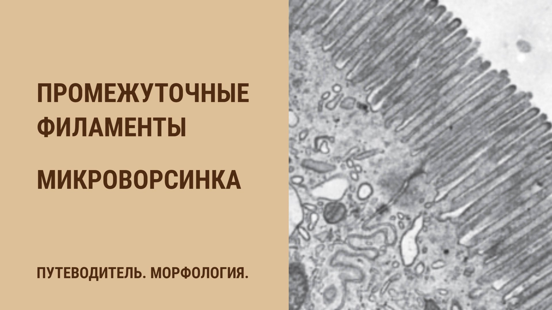 Промежуточные филаменты. Микроворсинка. смотреть онлайн