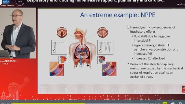 Respiratory effort in NIV pulm and cardio eff G. Grasselli (ESICM 23)