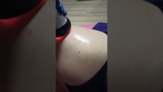 Вакуумный массаж после кавитации