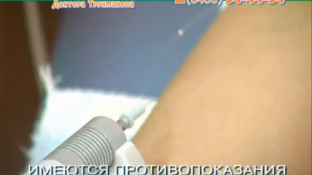 Внутривенное лазерное облучение крови ВЛОК смотреть онлайн