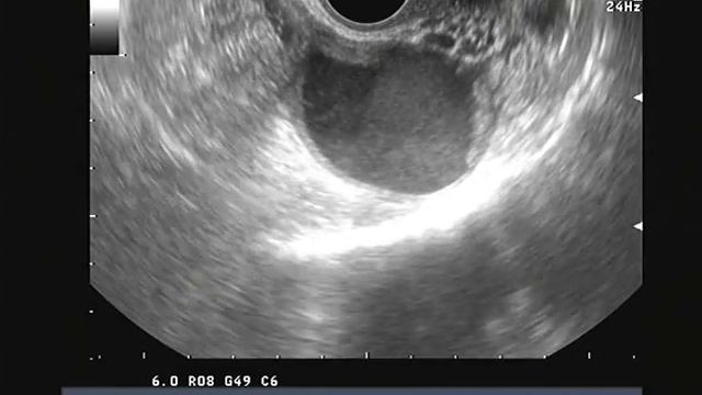 ЭКЯ739 смотреть онлайн