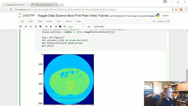 Visualizing - 3D Convolutional Neural Network w/ Kaggle and 3D medical imaging p.3 смотреть онлайн