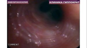 Как проводится бронхоскопия