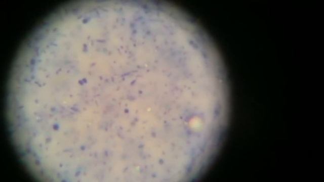 Движение микроорганизмов смотреть онлайн