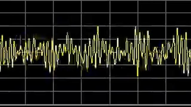 Detoxification (General) - Rife Frequencies смотреть онлайн