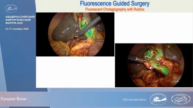 Доклад Луиджи Бони: «Флуоресценция с IMAGE1 S Rubina: от сумрака к свету» смотреть онлайн