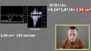 Обучение УЗИ сердца | Курсы ЭХО КГ | Эхокардиография