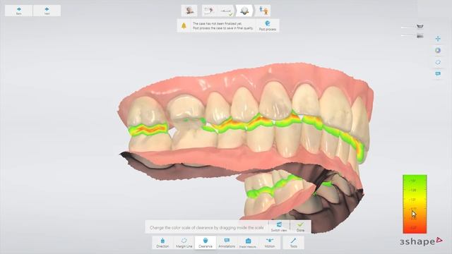 3Shape TRIOS - Analyze page tools смотреть онлайн