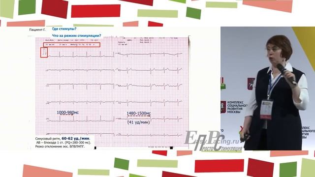 Желудочковая стимуляция. Разберемся почему чаще всего это «плохо», но иногда – «хорошо» смотреть онлайн