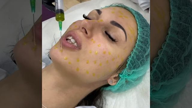 Пилинг BioRePeelCl3 (биорепил) смотреть онлайн