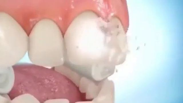 Брекеты ставят как детям, так и взрослым. смотреть онлайн