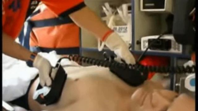 42.- Monitor Cardiaco con Palas смотреть онлайн