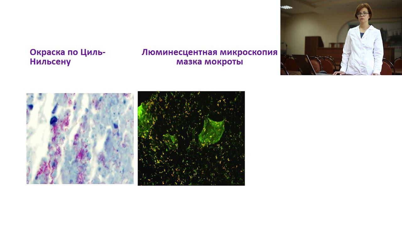 Классические методы этиологической диагностики ТБ