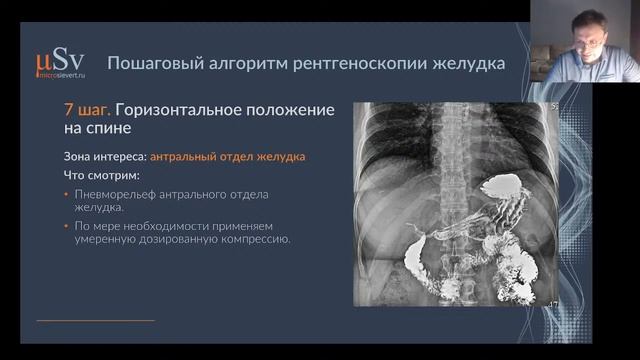 "Методика рентгеновского исследования верхних отделов желудочно-кишечного тракта" смотреть онлайн