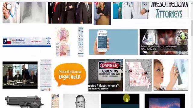 missouri mesothelioma lawyer Just another WordPress site смотреть онлайн