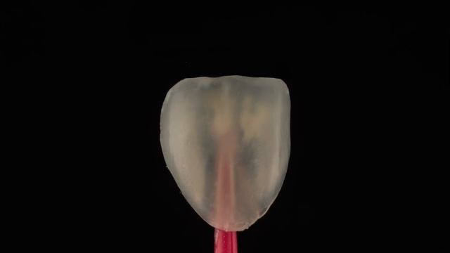 Feldspathic Veneers, the gold standard no prep veneer смотреть онлайн