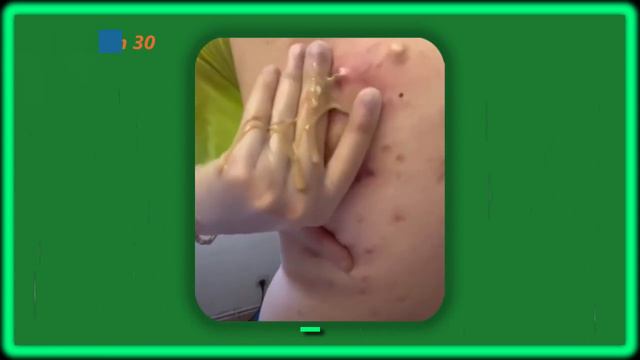 Brufolo con pus da vomito смотреть онлайн
