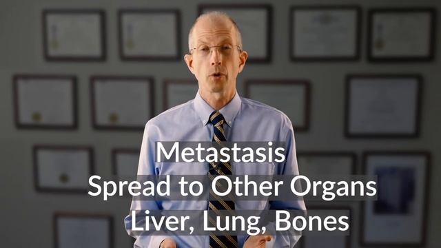 Esophageal Cancer Diagnosis and Staging смотреть онлайн