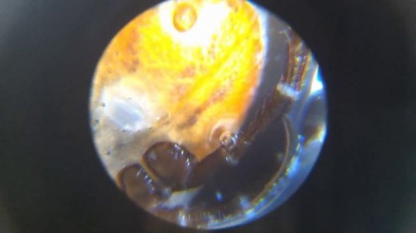 Клещ под микроскопом / A mite under the microscope