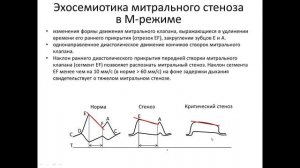 ОСНОВЫ ЭХОКАРДИОГРАФИИ. Митральный стеноз