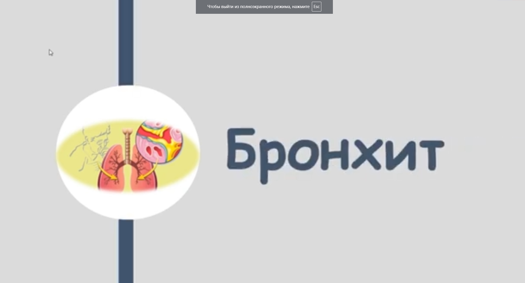 Бронхит, кашель. Лечение. Что делать при бронхите_ смотреть онлайн