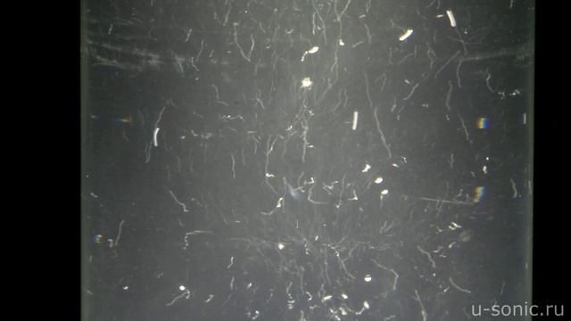 Ультразвуковая кавитация. Ультразвуковой аппарат "Булава'" смотреть онлайн