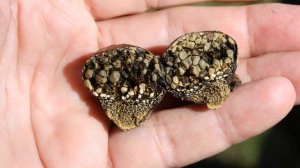 КАМНИ В ЖЕЛЧНОМ ПУЗЫРЕ | Почему появляются камни в желчном пузыре и как от них избавиться