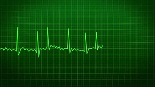 Screensaver 4k ABSTRACT | EKG monitor Screensaver - Background 4k NO SOUND смотреть онлайн