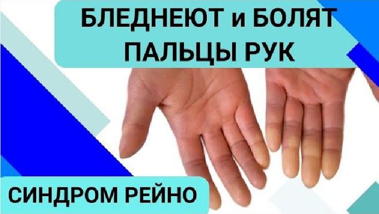 ДИАБЕТИЧЕСКАЯ СТОПА смотреть онлайн