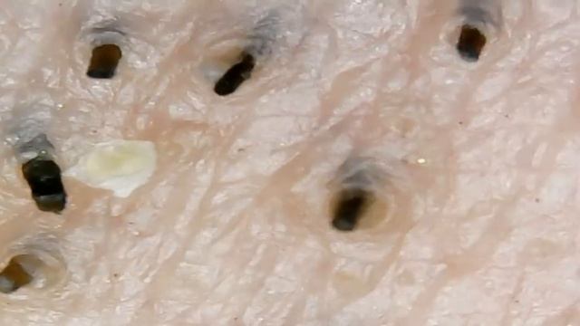 Beard under the microscope (борода под микроскопом) смотреть онлайн