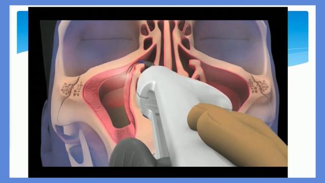 Sinus Solutions смотреть онлайн