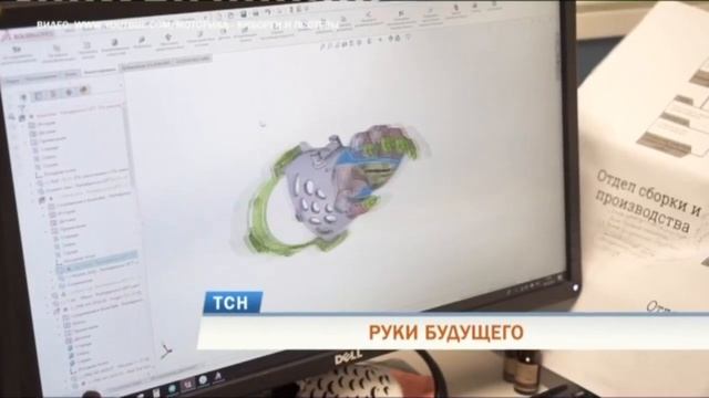 Мальчику из Перми изготовили протез руки на 3D-принтере Сколково смотреть онлайн