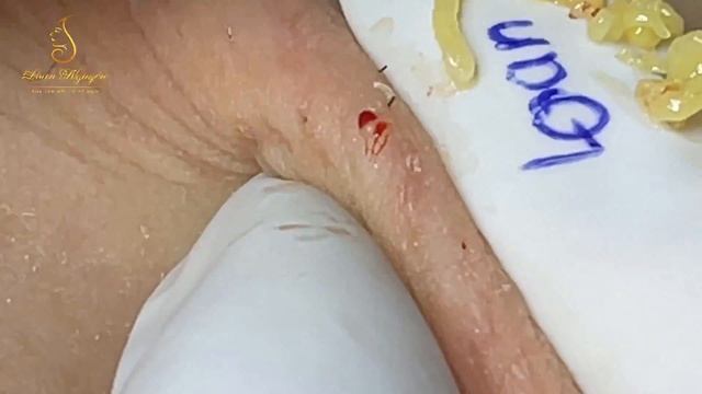 Satisfying With Loan Nguyen Spa Video #006 смотреть онлайн