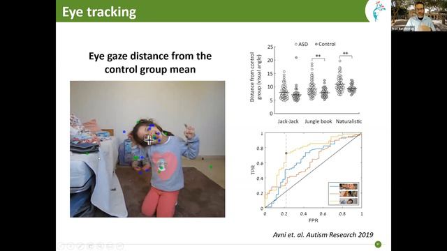 Webinar Wednesday - October 20th 2021 - Advancing Autism Diagnosis & Treatment смотреть онлайн