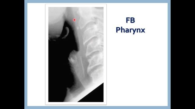 Upper GIT imaging (English Narration) смотреть онлайн