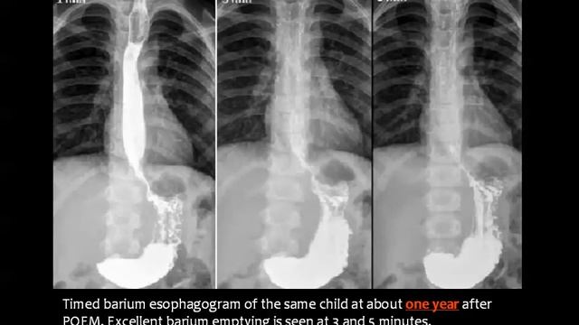 11 13 2018 11 48 12 AM GIT Pediatric I D13 смотреть онлайн