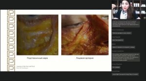 Вебинар КОРРЕКЦИЯ НОСОСЛЕЗНОЙ БОРОЗДЫ