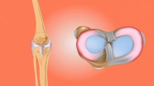 Шиповник не всегда и не всем полезен ..Что будет если пить чай из шиповника каждый день ?