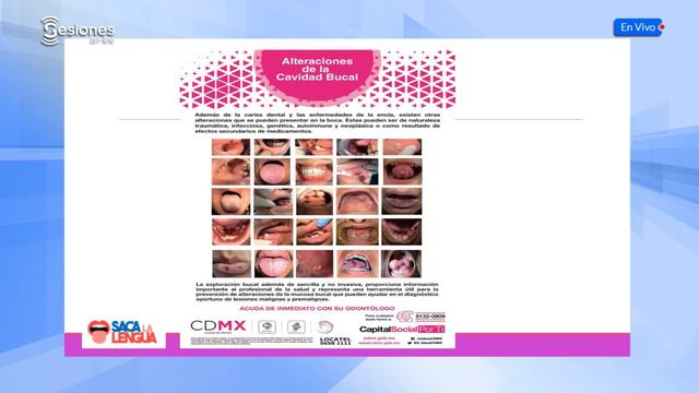 Sesión On-Line: "Cavidad bucal, características y exploración. Variantes de la normalidad" смотреть онлайн