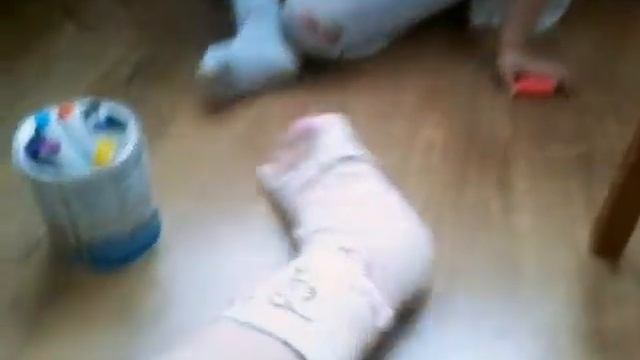 У меня гипс на ноге смотреть онлайн