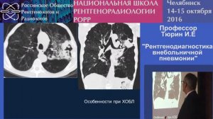 Рентгенодиагностика внебольничной пневмонии