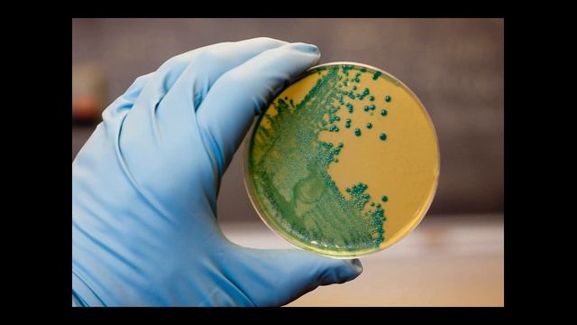 Листериоз – это инфекционное заболевание смотреть онлайн