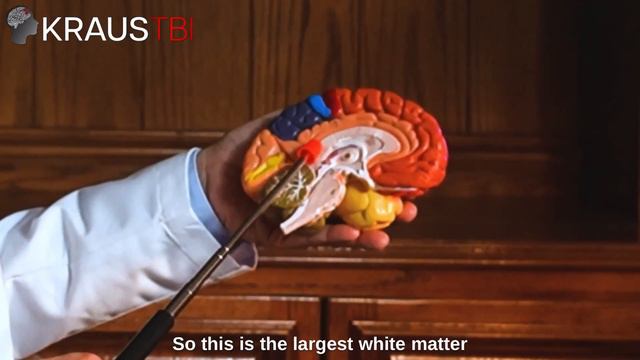Physics of Brain Injury and Low Velocity Motor Vehicle Accidents|Neurosurgeon Dr. Gary Kraus,Housto смотреть онлайн