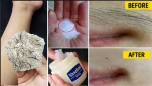 Прекратите бриться !!Это самый простой способ удалить волосы с лица тела и интимных зон.